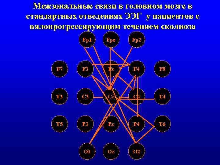 Межзональные связи в головном мозге в стандартных отведениях ЭЭГ у пациентов с вялопрогрессирующим течением