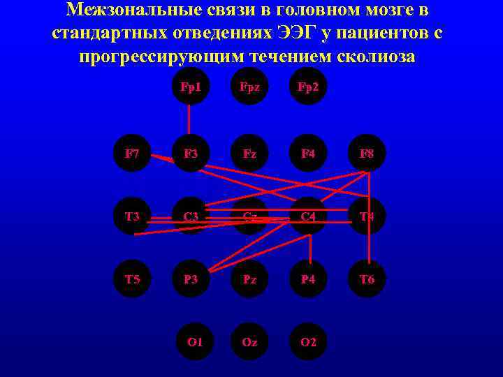 Межзональные связи в головном мозге в стандартных отведениях ЭЭГ у пациентов с прогрессирующим течением