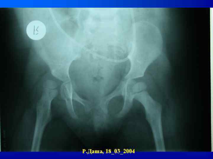 Р. Даша, 18_03_2004 