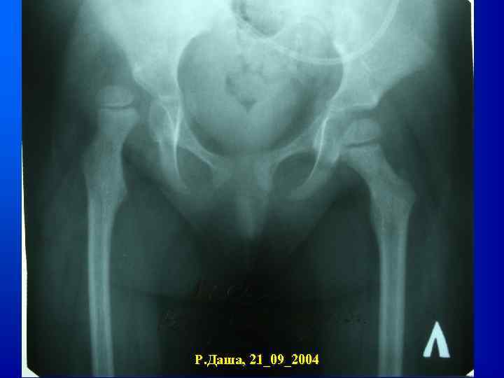 Р. Даша, 21_09_2004 