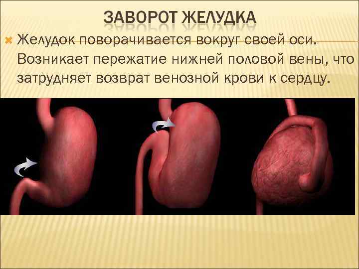  Желудок поворачивается вокруг своей оси. Возникает пережатие нижней половой вены, что затрудняет возврат