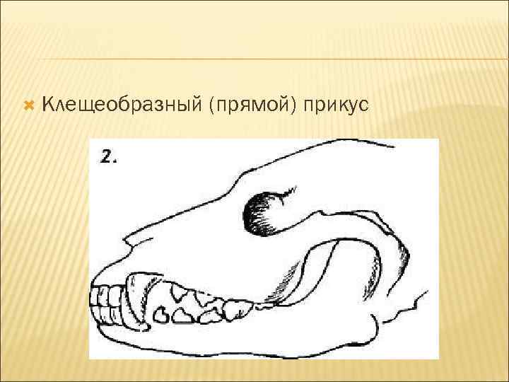  Клещеобразный (прямой) прикус 