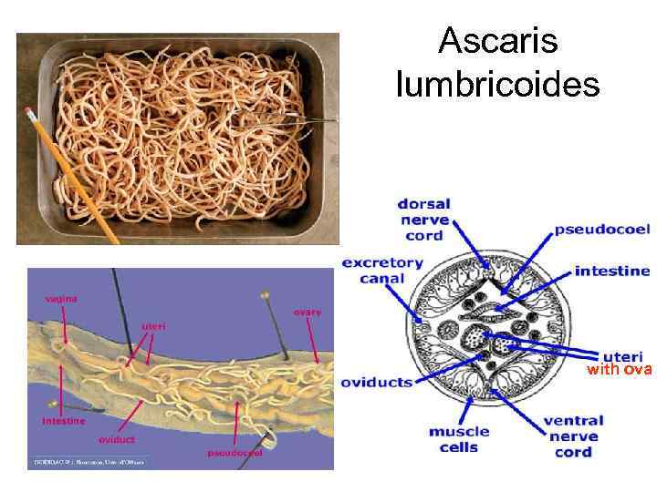 Ascaris lumbricoides with ova 