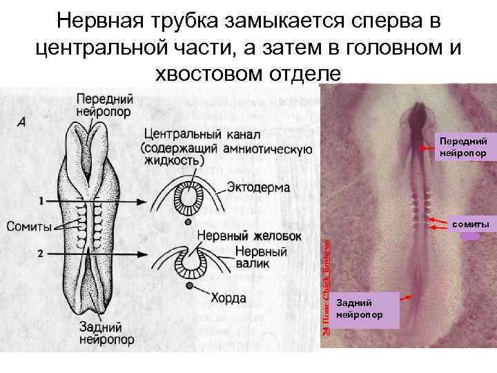 Нервная трубка замыкается сперва в центральной части, а затем в головном и хвостовом отделе