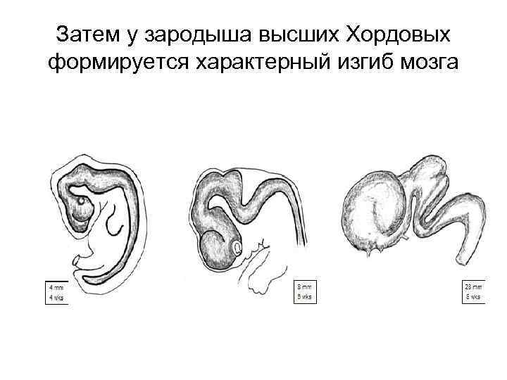 Затем у зародыша высших Хордовых формируется характерный изгиб мозга 