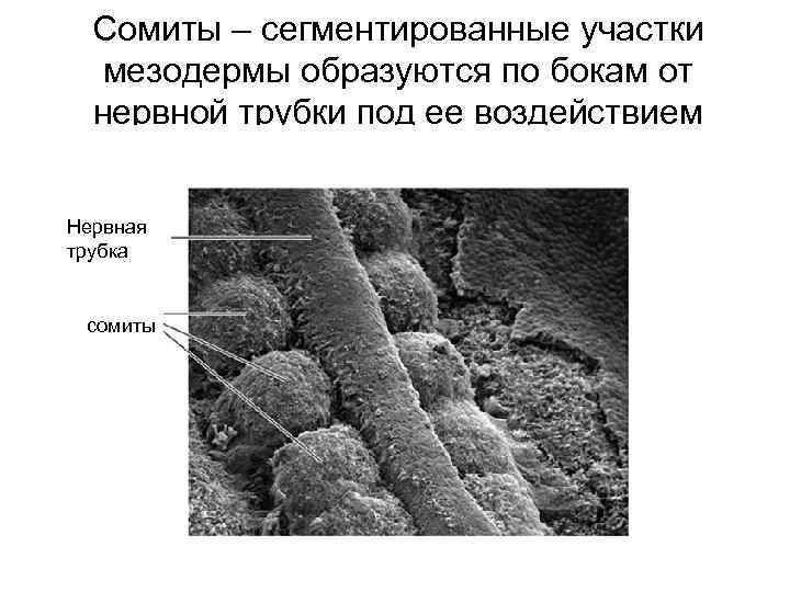 Сомиты – сегментированные участки мезодермы образуются по бокам от нервной трубки под ее воздействием