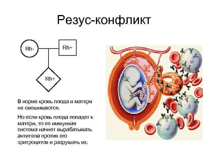 Резус-конфликт Rh+ Rh- Rh+ В норме кровь плода и матери не смешиваются. Но если