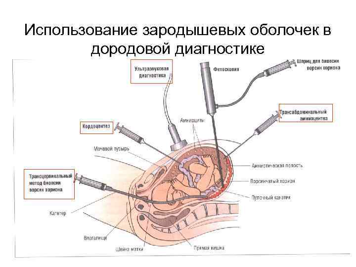 Использование зародышевых оболочек в дородовой диагностике 