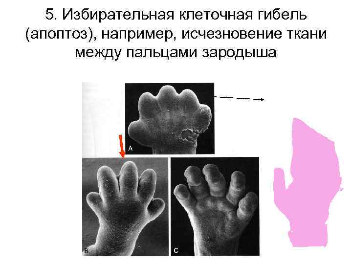 5. Избирательная клеточная гибель (апоптоз), например, исчезновение ткани между пальцами зародыша 