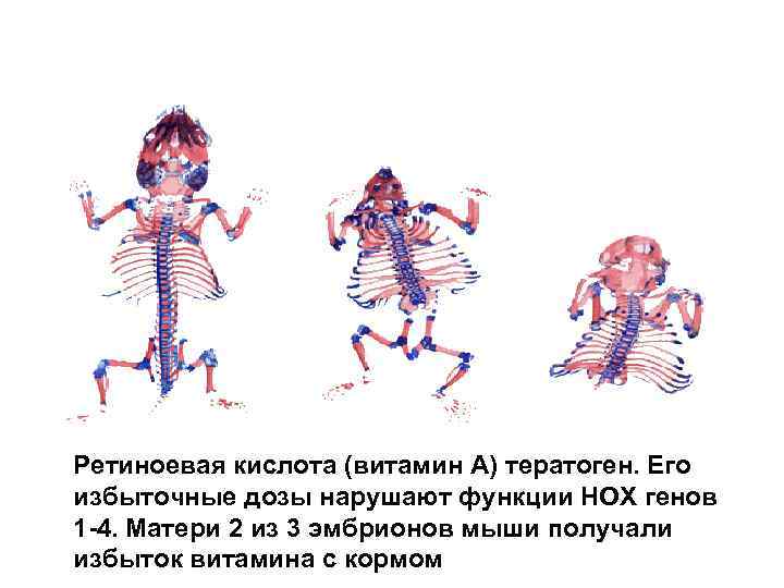 Ретиноевая кислота (витамин А) тератоген. Его избыточные дозы нарушают функции НОХ генов 1 -4.