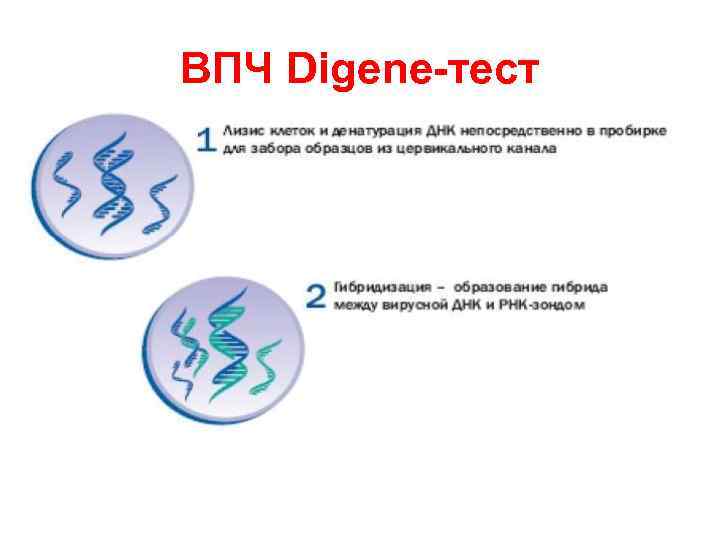 ВПЧ Digene-тест 