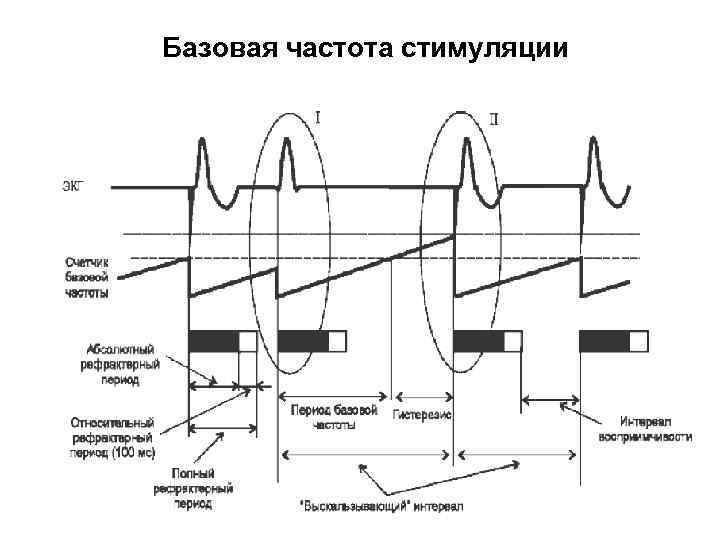 Базовая частота стимуляции 