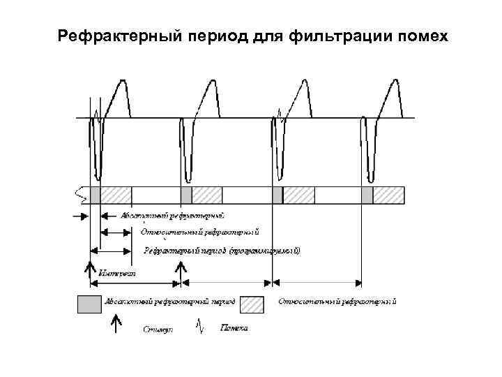 Рефрактерный период для фильтрации помех 