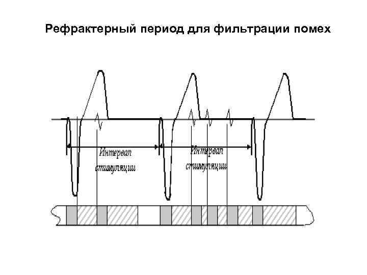 Рефрактерный период для фильтрации помех 