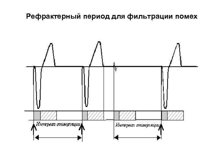 Рефрактерный период для фильтрации помех 