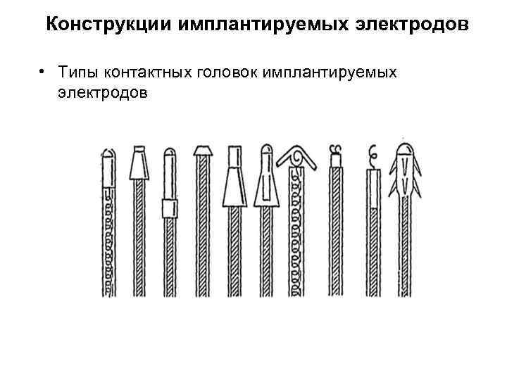 Конструкции имплантируемых электродов • Типы контактных головок имплантируемых электродов 