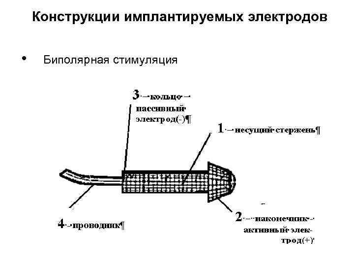 Конструкции имплантируемых электродов • Биполярная стимуляция 