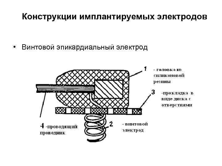 Конструкции имплантируемых электродов • Винтовой эпикардиальный электрод 