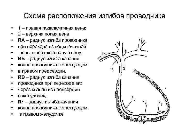 Вдоль правой стенки верхней полой вены располагается