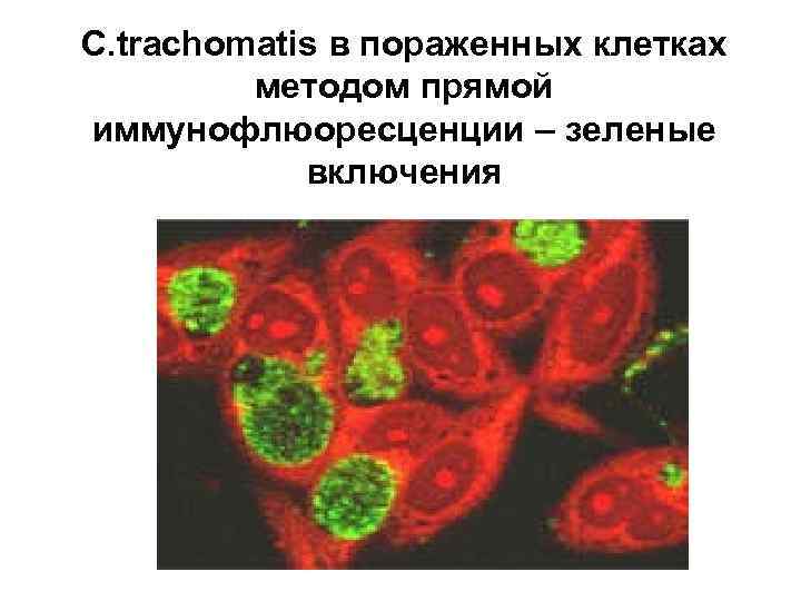C. trachomatis в пораженных клетках методом прямой иммунофлюоресценции – зеленые включения 