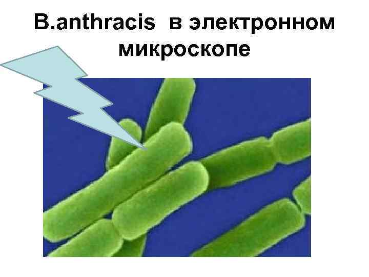 B. аnthracis в электронном микроскопе 