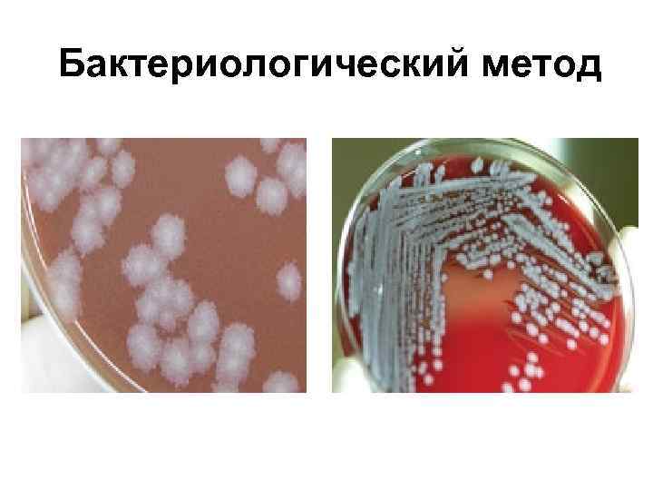 Зоонозные инфекции презентация