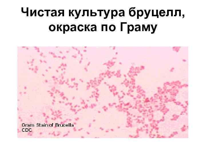 Чистая культура бруцелл, окраска по Граму 