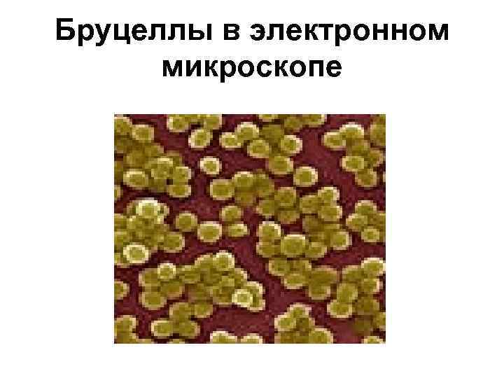 Бруцеллы в электронном микроскопе 