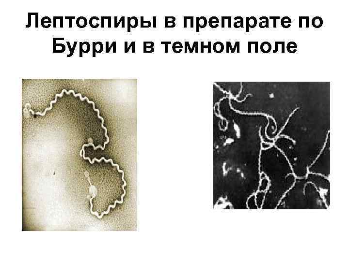 Лептоспиры в препарате по Бурри и в темном поле 