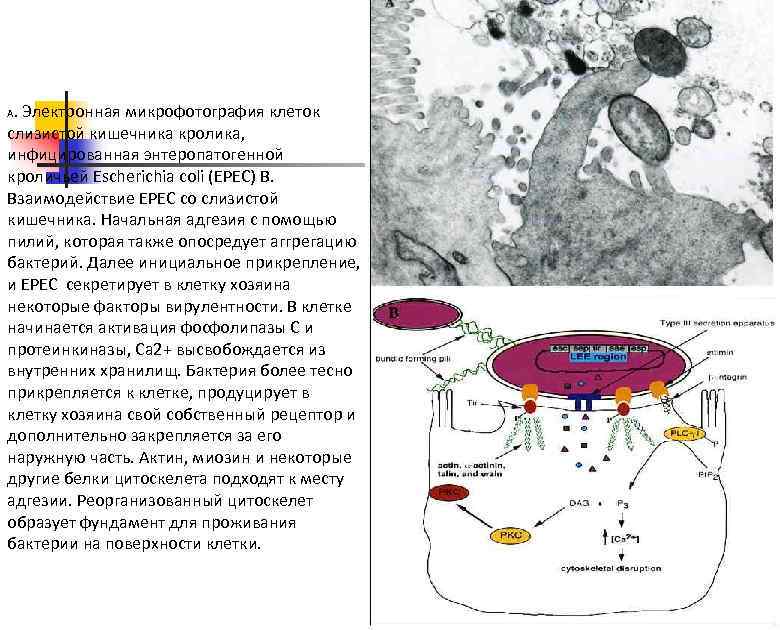 . Электронная микрофотография клеток слизистой кишечника кролика, инфицированная энтеропатогенной кроличьей Escherichia coli (EPEC) B.
