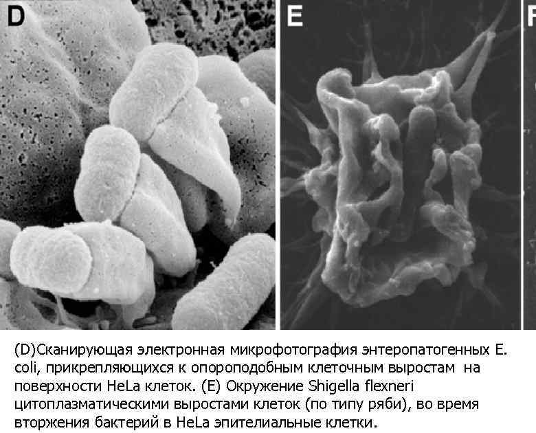 (D)Сканирующая электронная микрофотография энтеропатогенных Е. coli, прикрепляющихся к опороподобным клеточным выростам на поверхности He.
