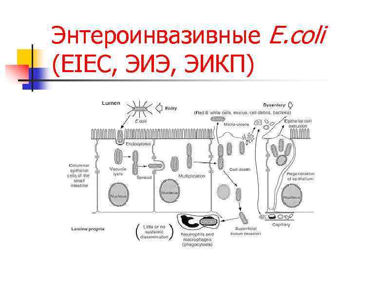 Энтероинвазивные E. coli (EIEC, ЭИЭ, ЭИКП) 