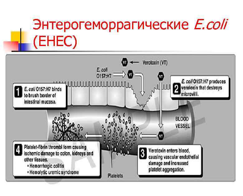 Энтерогеморрагические E. coli (EHEC) 