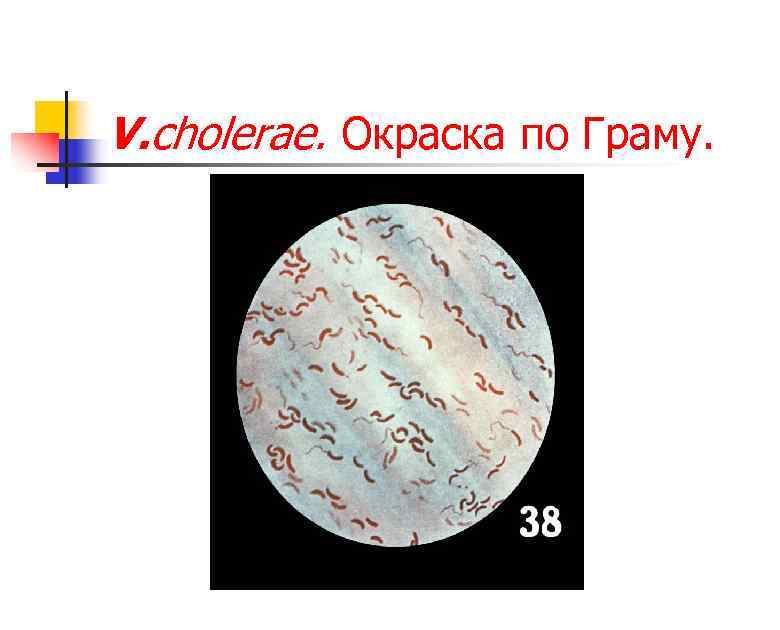 V. cholerae. Окраска по Граму. 