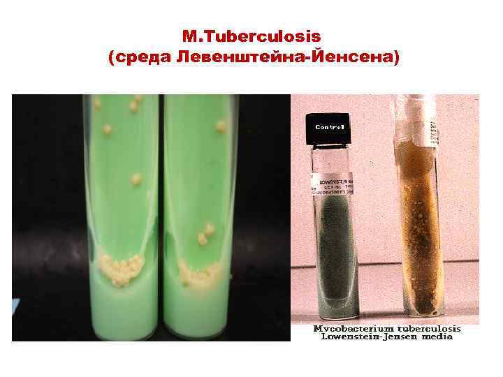 M. Tuberculosis (среда Левенштейна-Йенсена) 