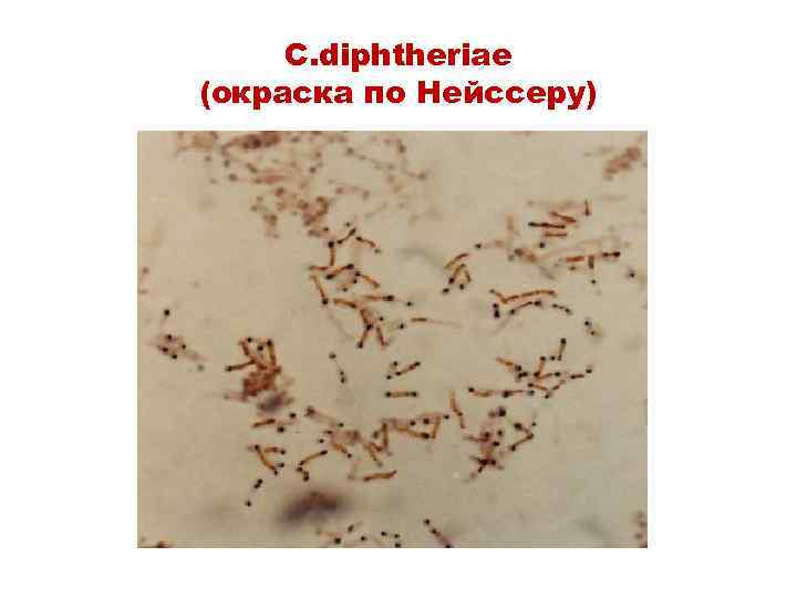 C. diphtheriae (окраска по Нейссеру) 