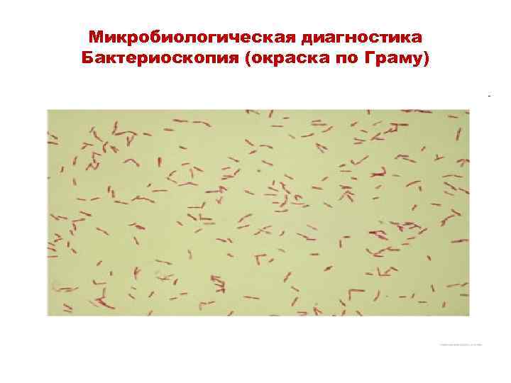 Микробиологическая диагностика Бактериоскопия (окраска по Граму) 