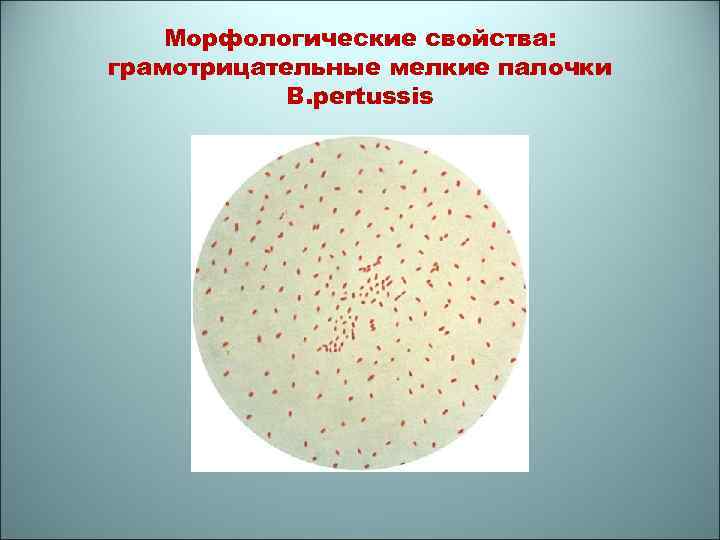 Морфологические свойства: грамотрицательные мелкие палочки B. pertussis 