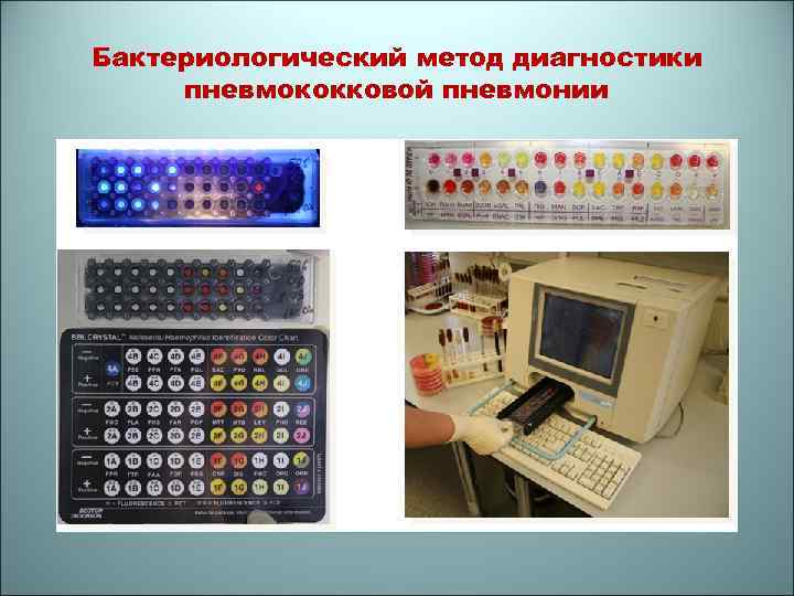 Бактериологический метод диагностики пневмококковой пневмонии 