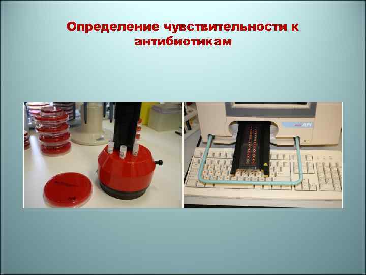 Определение чувствительности к антибиотикам 