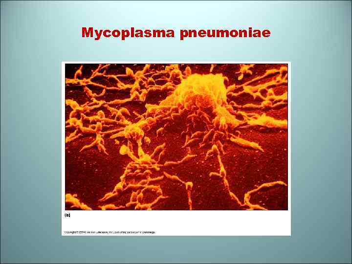 Mycoplasma pneumoniae 