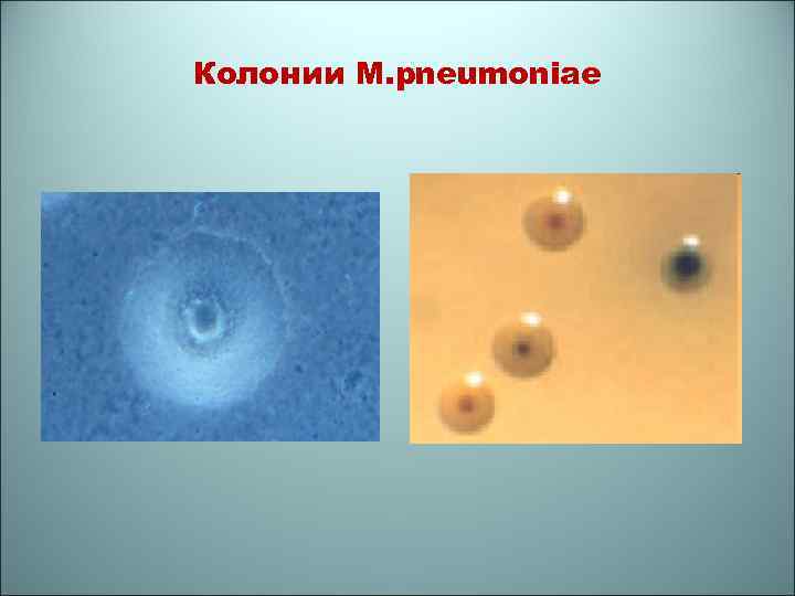 Колонии M. pneumoniae 