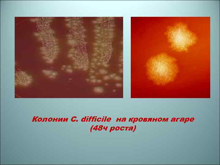Колонии C. difficile на кровяном агаре (48 ч роста) 