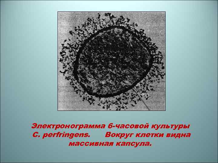 Электронограмма 6 -часовой культуры C. perfringens. Вокруг клетки видна массивная капсула. 