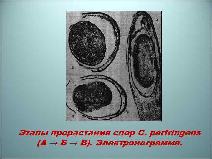 Этапы прорастания спор C. perfringens (A → Б → В). Электронограмма. 
