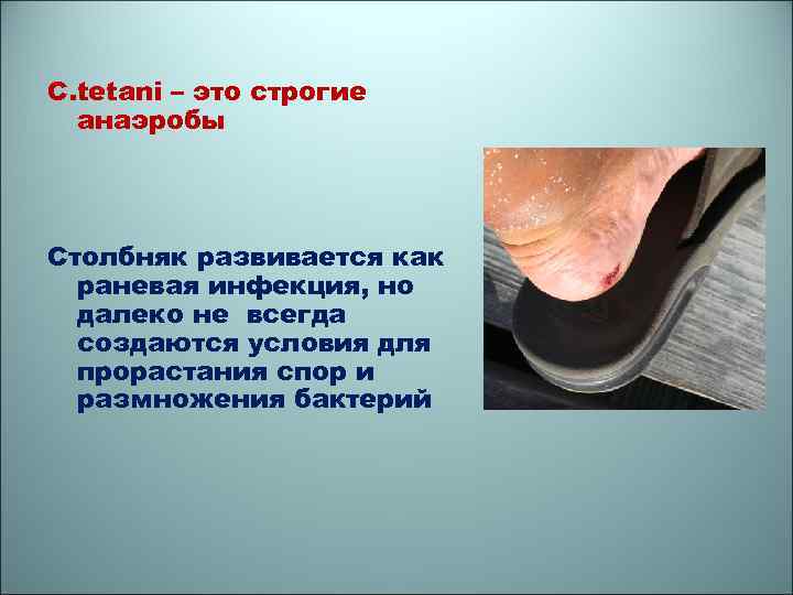 C. tetani – это строгие анаэробы Столбняк развивается как раневая инфекция, но далеко не