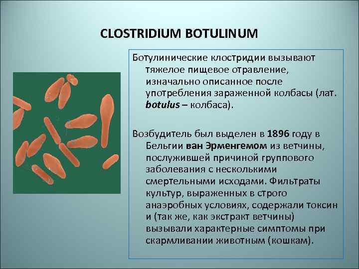 Возбудители после 60. Клостридии ботулизма ( Clostridium botulinum ) ботулизм. Пищевой токсикоинфекции, вызываемой Clostridium perfringens:. Clostridium botulinum заболевания. Клостридии ботулизма микробиология заболевания.