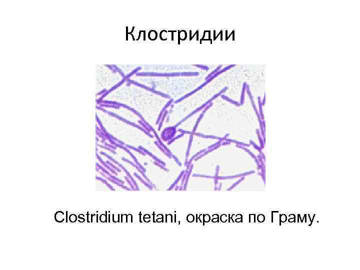 Клостридии Clostridium tetani, окраска по Граму. 