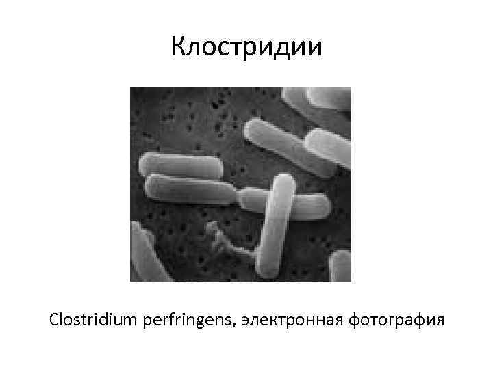 Клостридии Clostridium perfringens, электронная фотография 