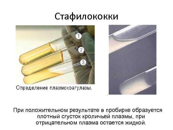 Стафилококки При положительном результате в пробирке образуется плотный сгусток кроличьей плазмы, при отрицательном плазма
